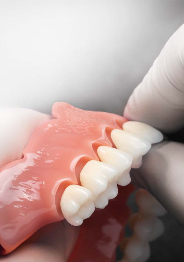 X-quang Implant ngắn 6.5mm BTI năm thứ 8