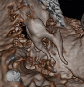 Máy chụp cắt lớp Cone Beam CT 3D Accuitomo 170 - MORITA