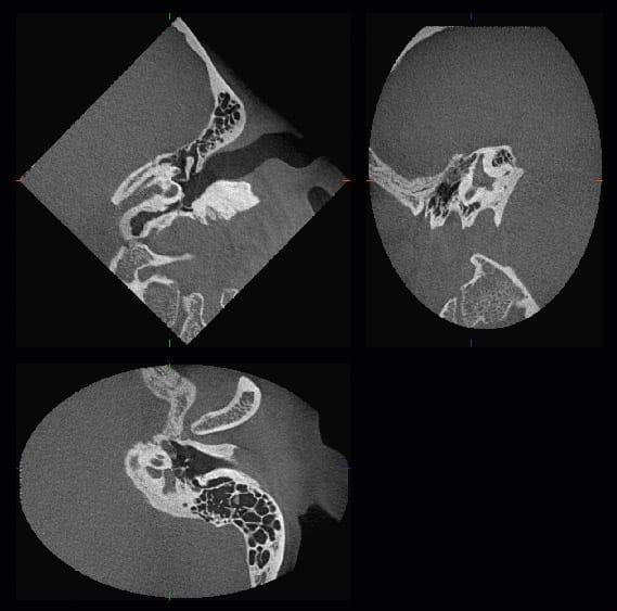 Máy chụp cắt lớp Cone Beam CT 3D Accuitomo 170 - MORITA