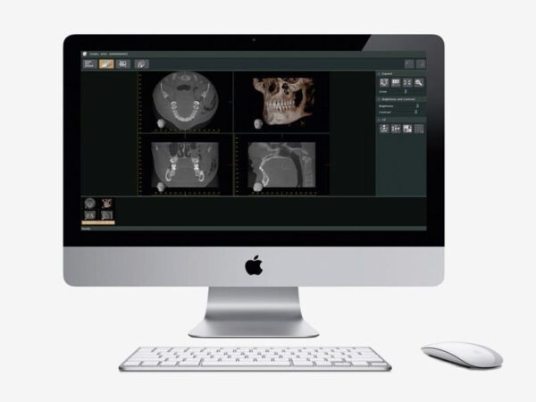 Phần mềm hình ảnh nha khoa i-Dixel WEB - MORITA