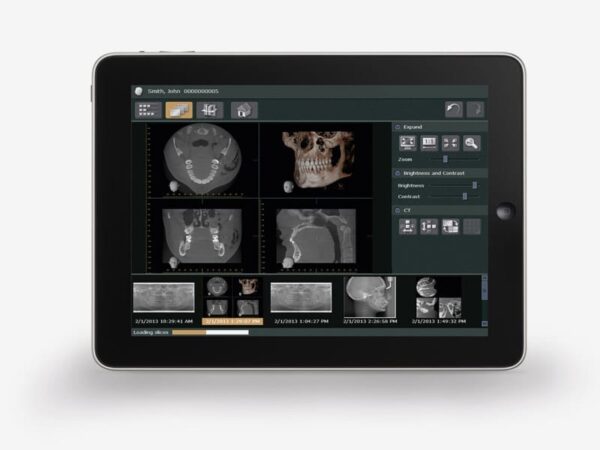 Phần mềm hình ảnh nha khoa i-Dixel WEB - MORITA