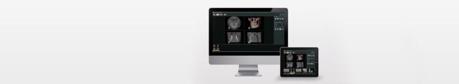 Phần mềm hình ảnh nha khoa i-Dixel WEB