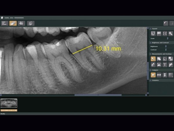 Phần mềm hình ảnh nha khoa i-Dixel WEB - MORITA