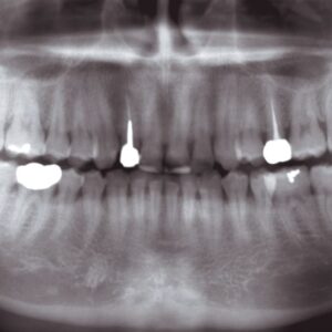 Máy X-quang toàn cảnh nha khoa Veraviewepocs 2D