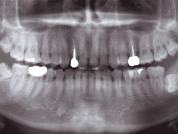 Máy X-quang toàn cảnh nha khoa Veraviewepocs 2D - MORITA